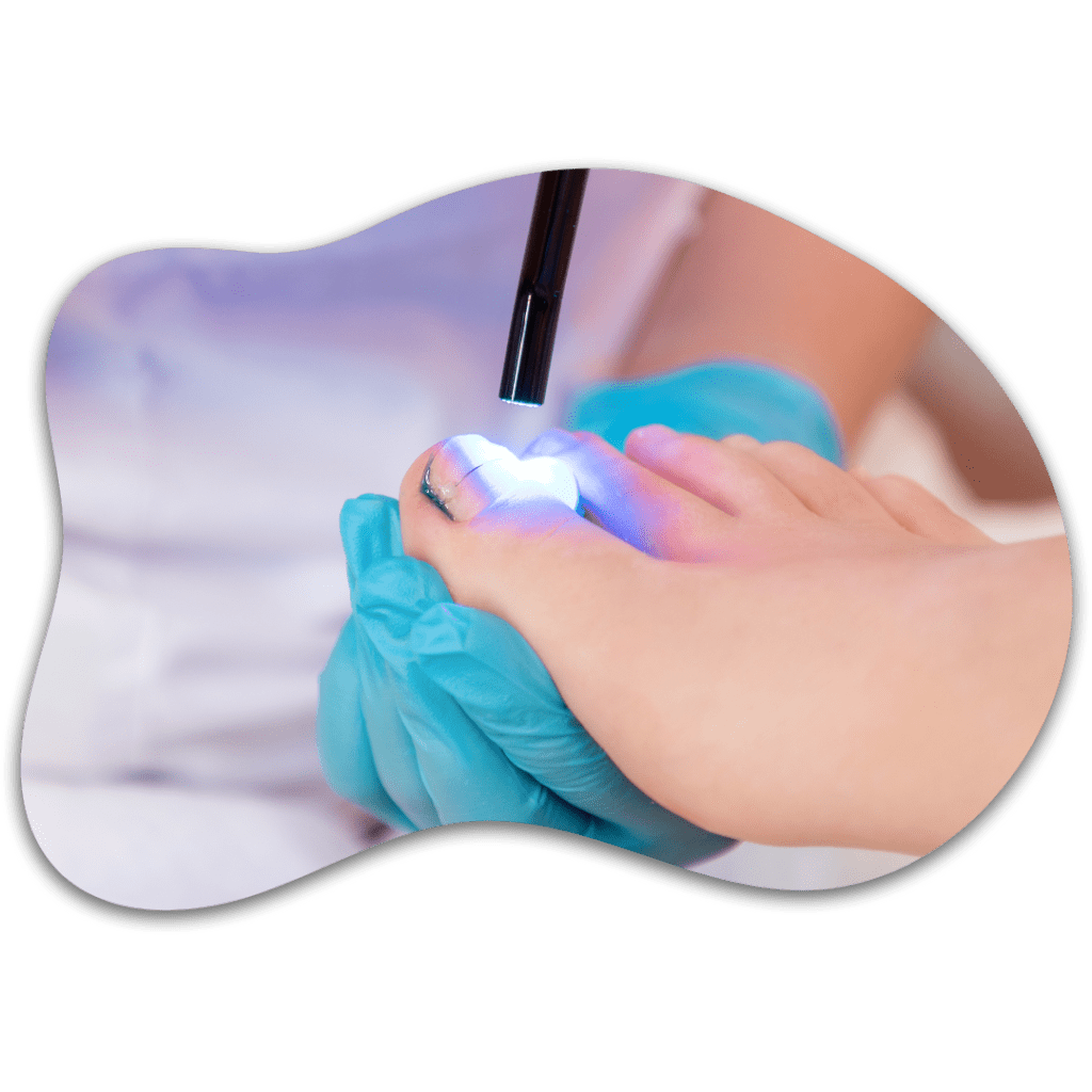 Reeducación y reconstrucción ungueal